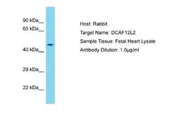 DCAF12L2 Antibody, Novus Biologicals 100 &mu;L | Buy Online | Novus Biologicals | Fisher Scientific